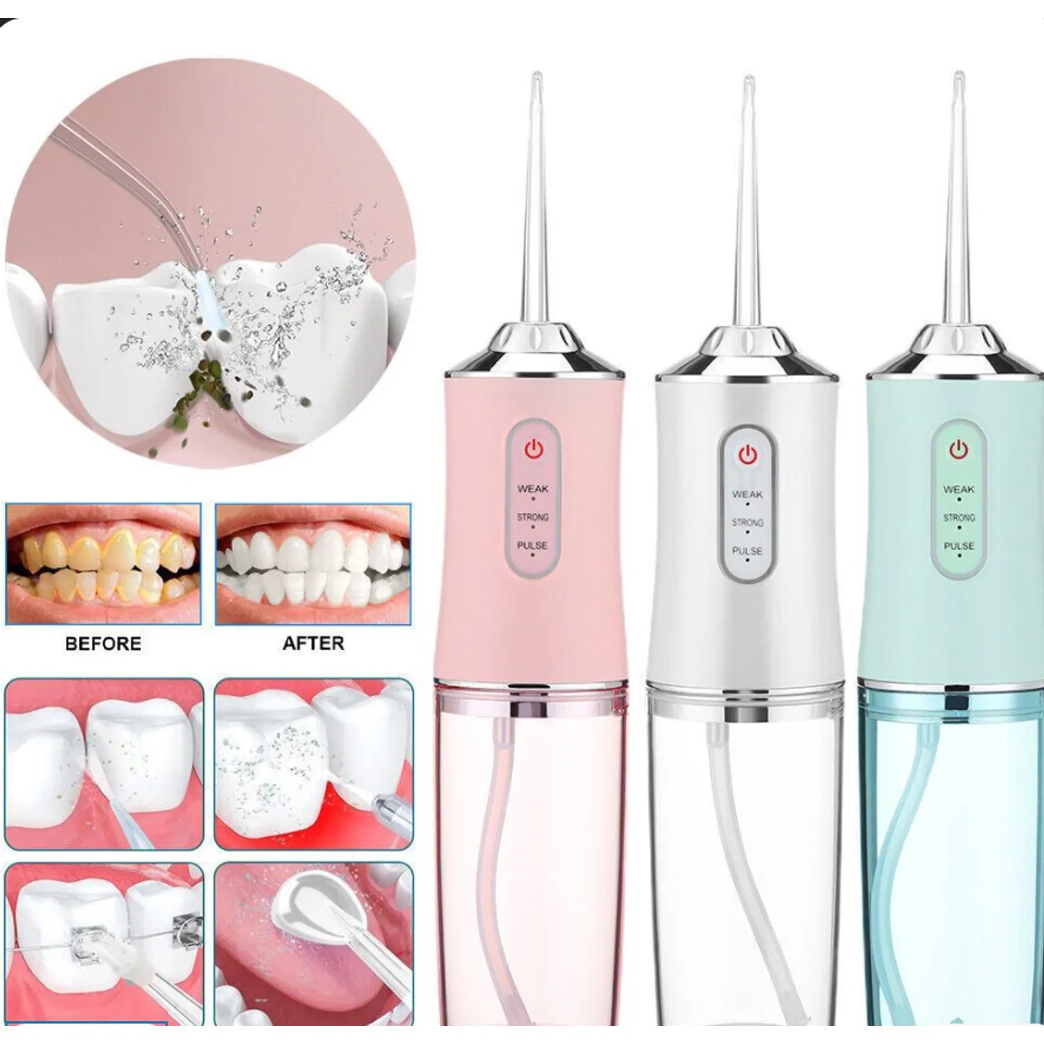 Limpieza Interdental Eficaz